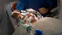 A patient undergoing deep brain stimulation in an operating room with an oxygen mask.