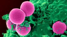 a brightly colored microscope image of an immune cell ingesting MRSA