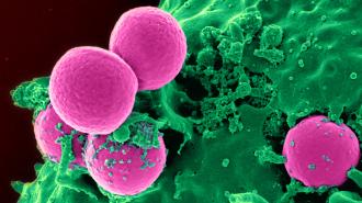 a brightly colored microscope image of an immune cell ingesting MRSA