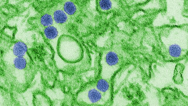 An image of the zika virus (in purple) infecting monkey cells (in green)
