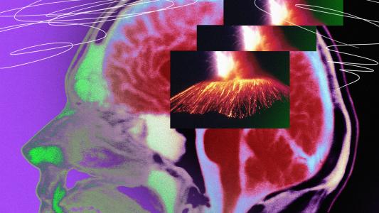 An MRI image of a brain highlighting productivity.