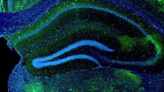 A blue and green image of a mouse brain.