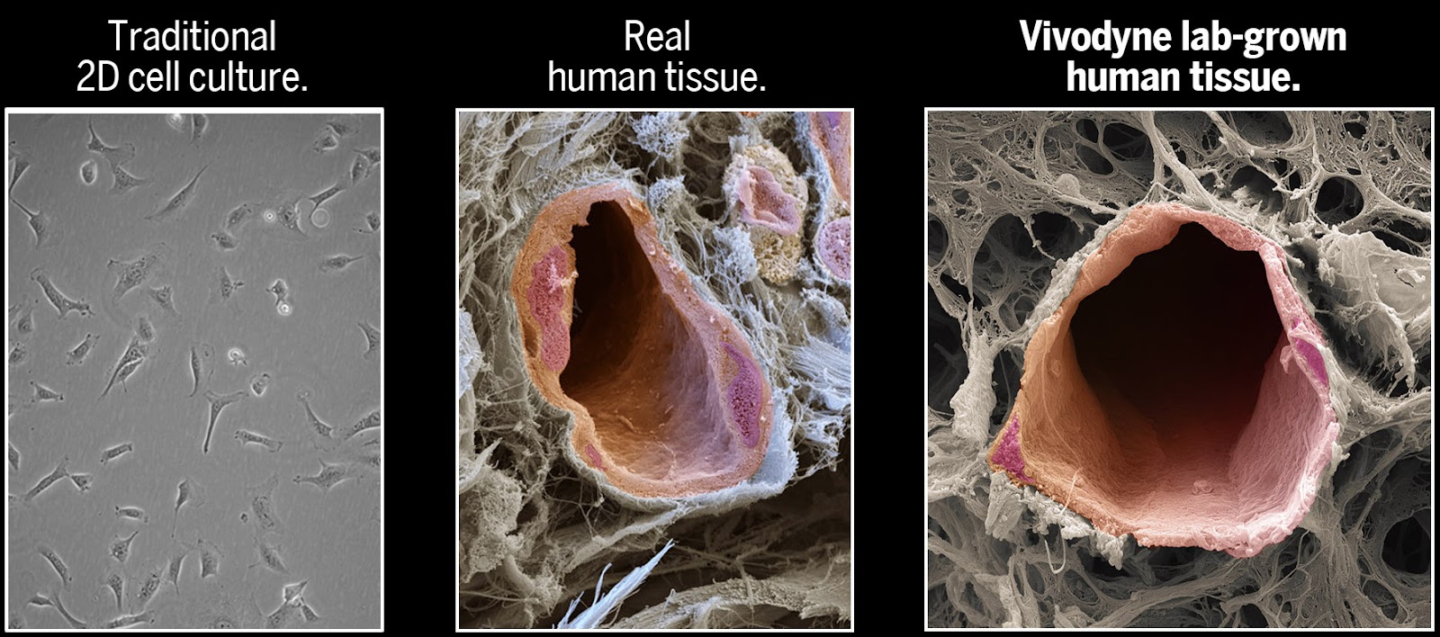 A high-magnification comparison cells in a petri dish (left), a blood vessel within native human tissue (middle). and Vivodyne’s lab-grown human tissue (right)