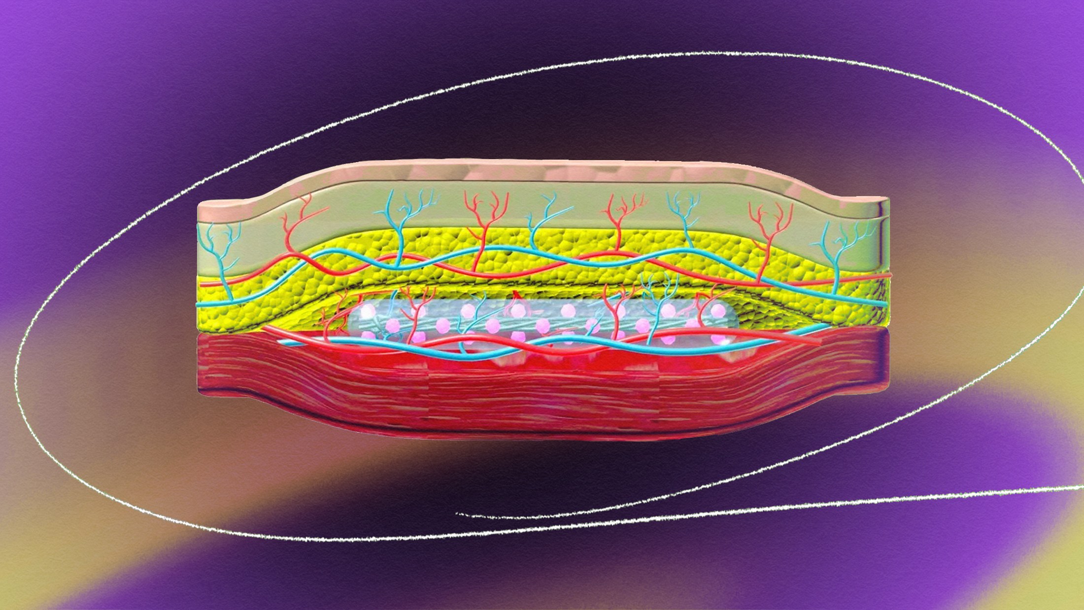 Experimental implant could end the need for insulin injections