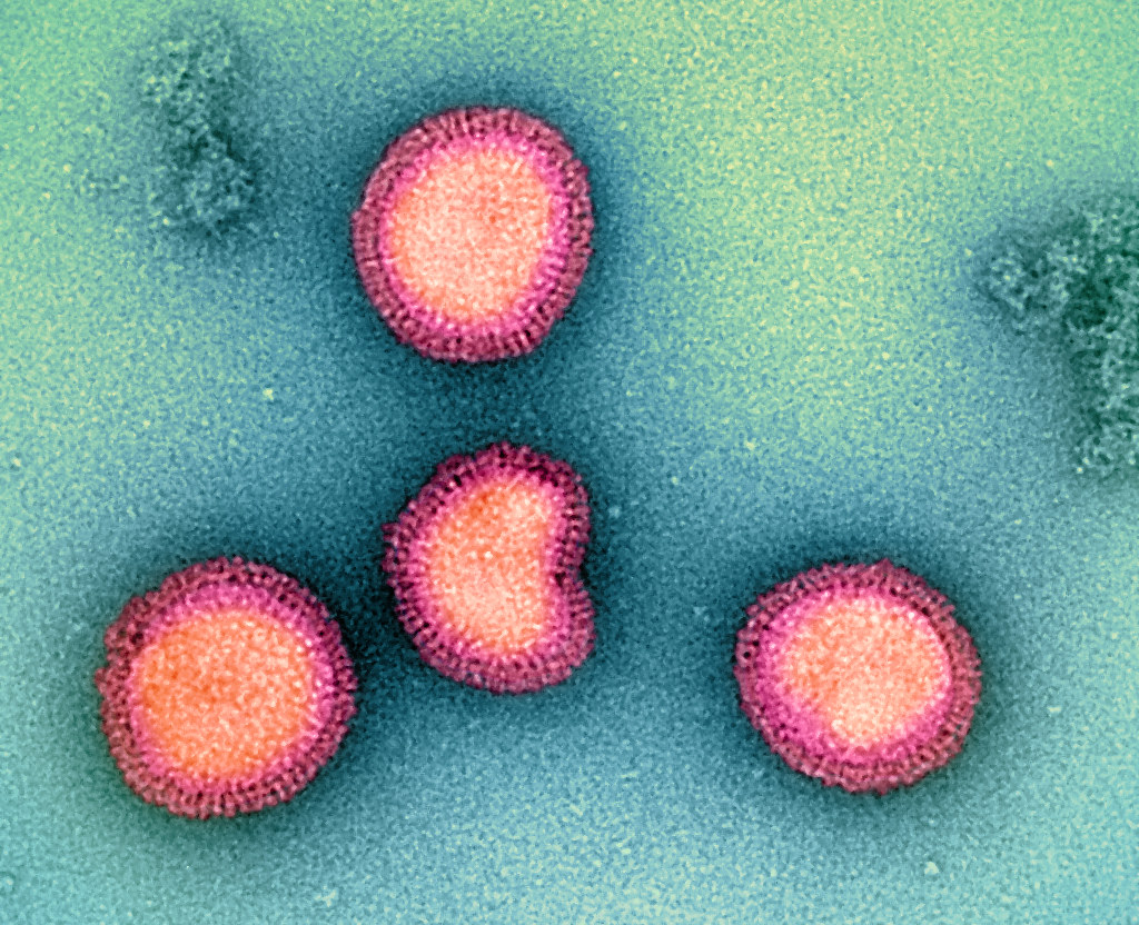 the vaccine wasn't as effective against the influenza b virus, seen here, in clinical trials