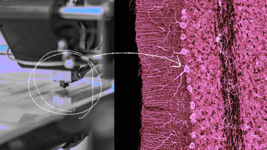 a collage of a 3D bioprinter and brain tissue