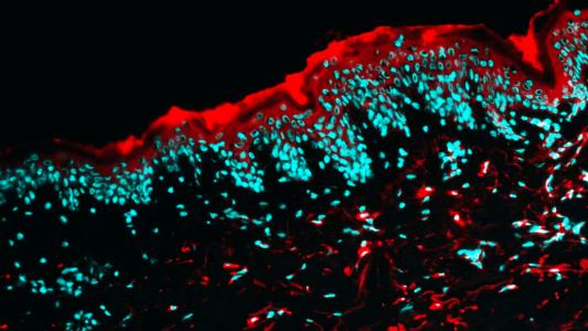 Microscope view of human skin treated with a short interfering RNA (siRNA) drug