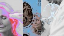 A collage featuring a woman undergoing brain stimulation and images of the brain
