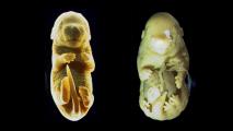 Side by side of mouse embryos. The one on the left appears to be developing normally, but the one on the right has an extra pair of legs.