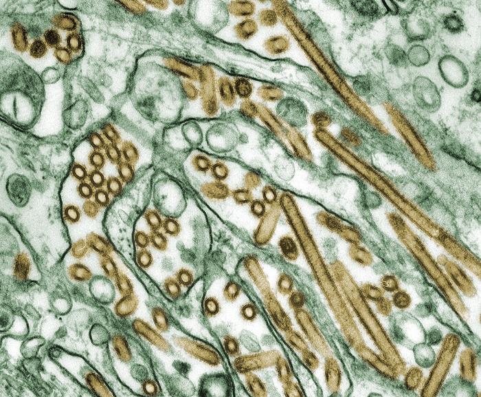 Electron micrograph of cellular structures in green and gold