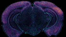 Microscopic image of a brain slice with fluorescent staining in shades of purple and blue, highlighting specific areas.