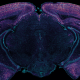 Microscopic image of a brain slice with fluorescent staining in shades of purple and blue, highlighting specific areas.